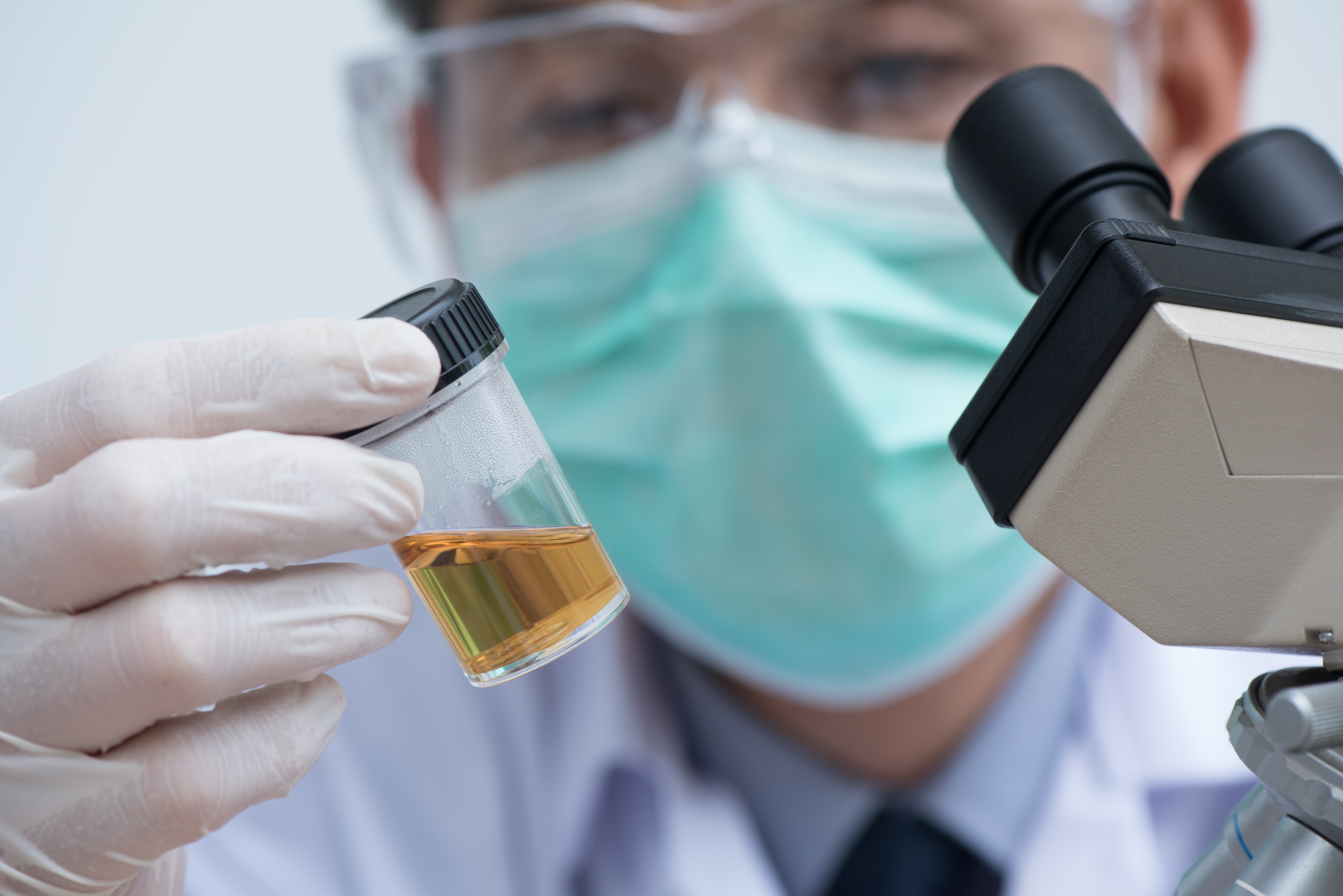 Scientist looking closely at a urine sample